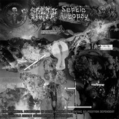 Endobronchial Metastasis Of Osteosarcoma Presenting As Position Dependent And Variable Airway Obstruction Of The Trachea (4-way split)