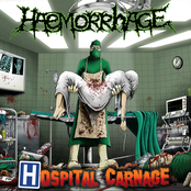 Necronatology by Haemorrhage