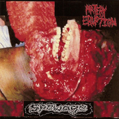 Liquified By The Human Decomposition Process by Artery Eruption