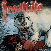 Frostbite: Frostbite