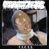 Post-Operative Mishaps / F.E.C.E.S.