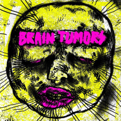 Brain Tumors 7"