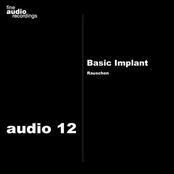 Turntable Tune by Basic Implant