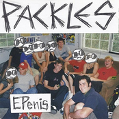 EPenis