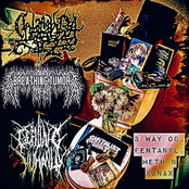 3 Way Od: Fentanyl, Meth N Xanax