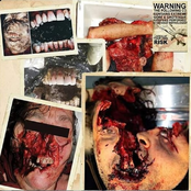 Gruesome Bodyparts Autopsy / Pulmonary Fibrosis / Take That Vile Fiend