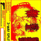 Decompurulent Ulcerator / Emetophagia / Cystoblastosis