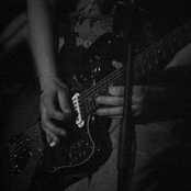umbilical chord E.P