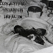 Neisseria Gonorrhoeae / Congenital Interior Defects