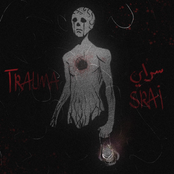Trauma