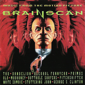 Brainscan