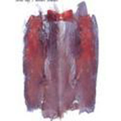 Our lungs are bleeding, but we keep breathing