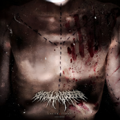 Lacerations: Autopsy Edition