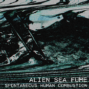 Spontaneous Human Combustion