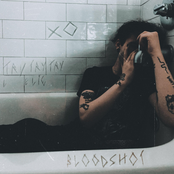 BLOODSHOT