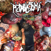 Postpartum Endometritis / PIZDABLASTOMA!