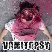 Vomitopsy