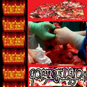The Ultimate Gross Out (Gorenoise Demo 4)