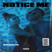 Skeete: Notice Me