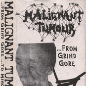 Grind Core God by Malignant Tumour