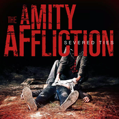 The Amity Affliction: Severed Ties