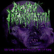 Putrid Pulmonary Abscess In Emphysema-bladders In Primary Atypic Pneumonia