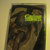 Unclogging The Putrid Impaction