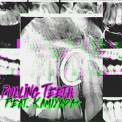 Sorry X: Pulling Teeth