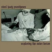 Sterile by Steel Hook Prostheses