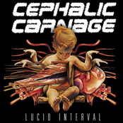 Redundant by Cephalic Carnage