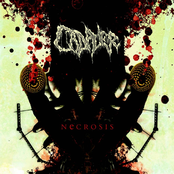 Cadaver: Necrosis