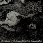 Symphonies of Supraclavicular Suppuration