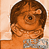 The Castrull Of Borsch / Alobar Holoprosencephaly