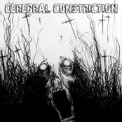 cerebral constriction