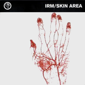Skin Area/IRM Split