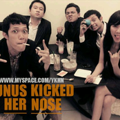 yunus kicked her nose