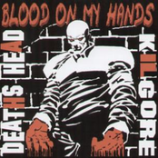 Blood on my hands