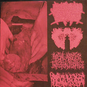 Agonizing Excess Bowel Acid Dissolving the Intestines Causing Massive Organ Trauma / Carcinomas of Unknown Primary Origin / Rectal Abscess Infection Discharge / Hydrocephalus split