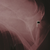 Pain Is On Our Side Now