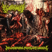 Ingurgitating Mortuary Viscera