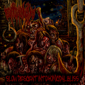 Slow Descent Into Homicidal Bliss