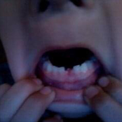 Mi Último Respiro en la Tierra