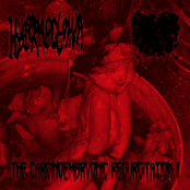 The Carcinoembryonic Regurgitation II