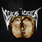 Doenças Venéreas
