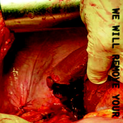 We Will Remove Your Body Interior