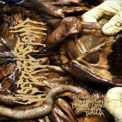 Postquirurgical Complication Of Bowel - Closed Abdominal Trauma