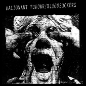 blood suckers / malignant tumour