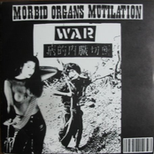 War ep
