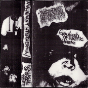 Malignant Hyperthermia / Goulash Of Emetic Waste