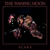 Scars